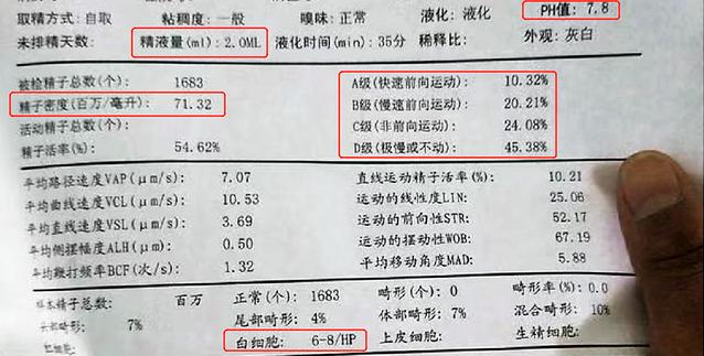 精液常规检查需要禁欲多久 怎么看懂精液常规检查报告单